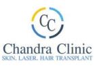 Best Hair Transplant in Delhi -Chandra Clinic