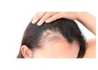 Specialized Dermatologist for Hair Loss at London Dermatology Clinics